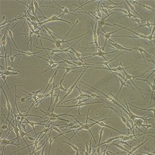 human-epidermal-melanocytes 人表皮黑素细胞