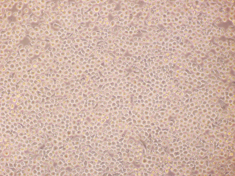 Expansion of human hematopoietic stem cells. Expansion of human hematopoietic stem cells