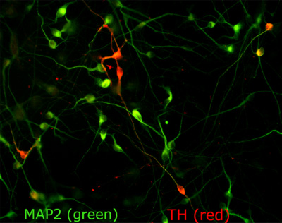 Dopaminergic neurons Small ovals indicating the cell body of the neurons cluster in the center of the image, connected by thin lines.