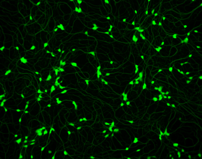 Spinal Motor Neurons Irregular filled circles connected by faint lines cover the entirety of the image.