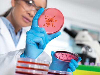 Microbiological culture media 微生物培养基用于检测食品和水样污染情况