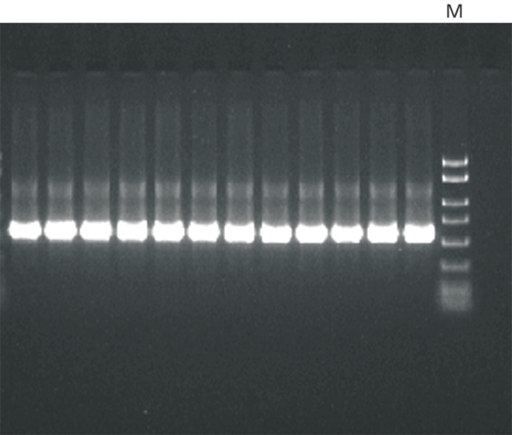 PCR扩增 PCR扩增