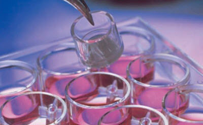Millicell culture plates and inserts support Millicell® 培养皿可获得与生物相关的结果