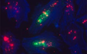 转染细胞在蛋白表达和基因功能研究中的应用 转染细胞在蛋白表达和基因功能研究中的应用