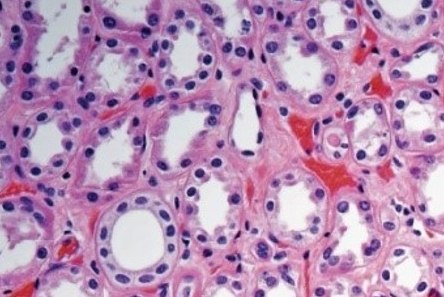 Histological staining of Paraffin-embedded kidney sections H&E染色石蜡包埋肾切片的组织病理学检查