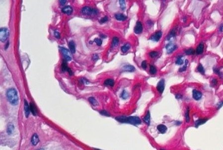Histological staining of Paraffin-embedded kidney sections Microscopic view of stained tissue sample under a microscope