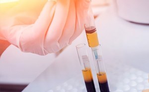 Faster production of blood plasma products