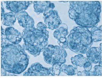 MCF-7 breast cancer cell culture MCF-7 tumorsphere formation