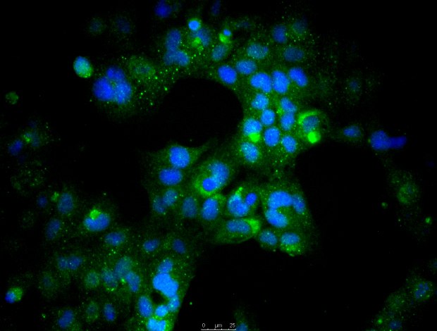 HL-1 mouse cardiac muscle cells Fluorescent staining of perinuclear ANF and nuclear DAPI in the presence of HL-screened FBS