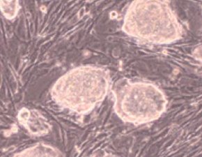 Mouse embryonic stem cells Mouse embryonic stem cells grown with qualified FBS