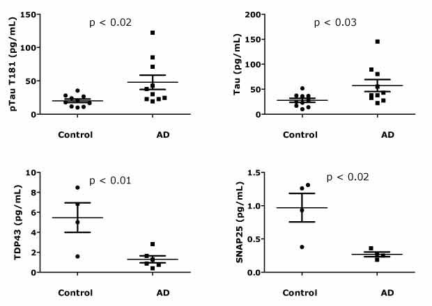 High Sensitivity Analysis of Neurodegenerative Disease Biomarkers Concentrations of neurodegenerative disease biomarkers phosphorylated Tau (T181), total Tau, TDP-43, and SNAP-25 analyzed with ultrasensitive SMC® immunoassays.