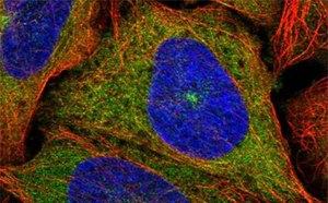 Anti-KIF5B Prestige Antibodies® Produced in Rabbit. Highly characterized and validated Prestige Antibodies®.