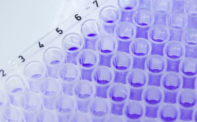 Close-up photograph of 96-well metabolite library plate with crystal violet solution 在实验室中,使用多吸管将含有紫罗兰色溶液的样品添加到代谢库试剂盒的深孔托盘中的特写照片。