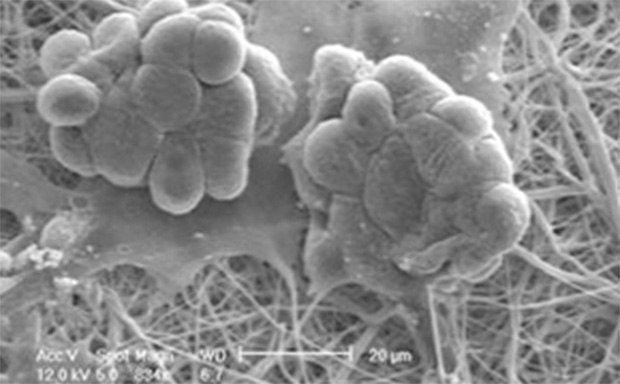 Scanning electron microscope image depicting clusters of microbial cells adhering to a fibrous network, displayed in monochrome for detailed texture analysis.