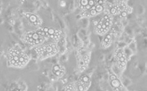 Cells are filled with circles of various sizes indicating lipid droplets. The visible lipid droplets and cells span the foreground of the image. 