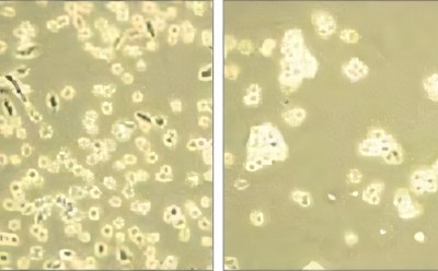 Cell dissociation 解离试剂细胞分离过程明场显微镜图像