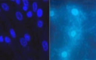 Common DNA detection agents such as DAPI or Hoechst reveal the presence of mycoplasma in contaminated cultures using fluorescent microscopy.