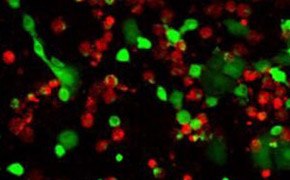 活/死细胞双重染色