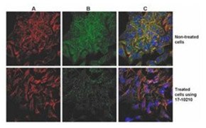 Cytoskeletal enrichment assays Cytoskeletal enrichment assays