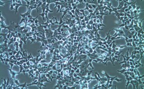 Microscopy image of HEK-293T cells. Rectangles with large spikes that emanate from the corners represent the cells cover the entire image. 