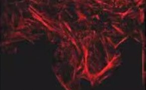 F-actin is visible in the cells as long straight lines that cover the cells. These lines cover the top of the image and expand into the bottom middle of the image.