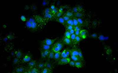 Fluorescnet staining of perinuclear ANF (green) and nuclear DAPI (blue) in the presence of HL-1 screened FBS