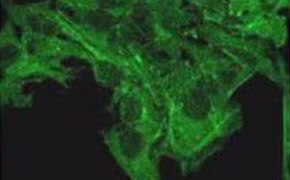 Small dots cover the surface of the cells, so no dot is completely visible. The cells cover the top of the image and expands into the bottom middle of the image.