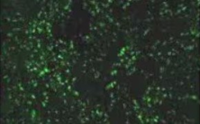 Small dots cover the surface of the cells, and each dot is visible from another. The cells cover the entirety of the image.