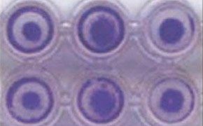 A close-up image of a 96-well plate with each well containing HT-1080 cells with a distinct darker circular pattern in the center. The wells are arranged in two rows of three.