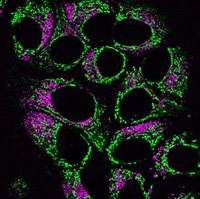 采用BioTracker NIR650溶酶体染料和BioTracker 488 Green线粒体染料共染的活HeLa细胞。