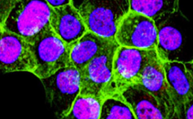 Mammalian Cell Lines