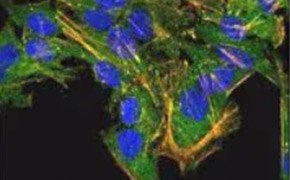 Small dots cover the surface of the cells so no dot is completely visible. F-actin is visible in cells as long straight lines that cover the cell. The nucleus is visible as an oval in the middle of each of the cells. These cells cover the top of the image and extend into the bottom middle of the image.