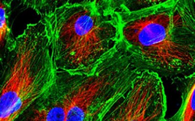 The image appears to be a microscopic view showing various cellular structures. It features cells with blue nuclei, green cytoskeleton fibers, and red mitochondria.