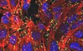 Small dots cover the surface of the cells, and each dot is visible from another. F-actin is visible in the cells as long straight lines that cover the cells. The nucleus is visible as an oval in the middle of each of the cells. These cells cover the entirety of the image.