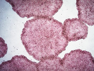 H9 human ES cells stained with alkaline phosphatase (AP) The image appears to show a collection of irregularly shaped, purplish-pink blobs against a pale background.