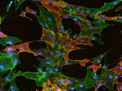 Fluorescent ICC staining of mesenchymal stem cells Mesenchymal stem cells fluorescently stained for immunocytochemistry
