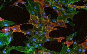 Mesenchymal stem cells
