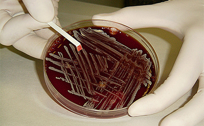 集试纸条、圆片和膜片于一体，使用方便的生化检测试剂盒