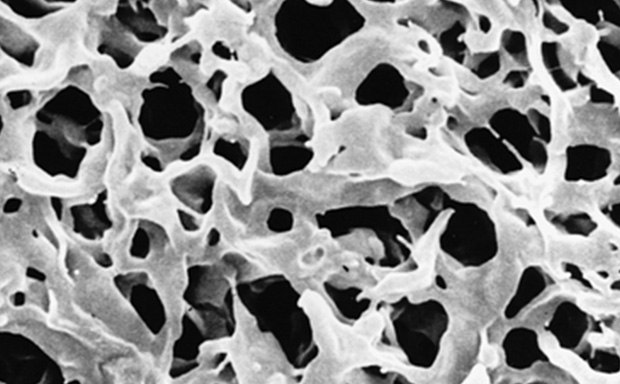 Laboratory Filter Membranes