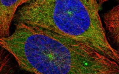 Anti-KIF5B Prestige Antibodies® Produced in Rabbit. Highly characterized and validated Prestige Antibodies®.