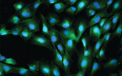 使用Anti-von Wille进行马肉芽组织增生（肉芽增生）的染色