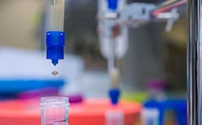 Protein Purification Chromatography Protein Purification Chromatography