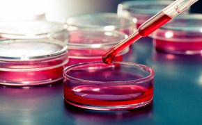 几个装满粉红色液体培养基的培养皿特写图。在前景中，一支移液管正将红色液体注入其中一个培养皿。背景包含更多培养皿，环境透露出这是典型的无菌、受控生物研究环境。