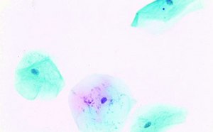 Papanicolaou staining of vaginal sample