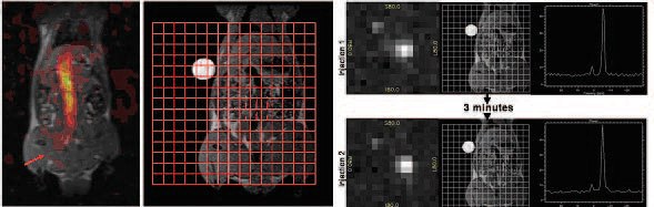 Real time 3D 13C in vivo rodent imaging with PASADENA. Hyperpolarized 13C imaging reagents were administered via jugular vein, and the resulting ultra fast 13C MR images displayed as overlay on proton images of the same animal. The advantage of 3D FIESTA is the ability to reconstruct 3D images as shown in A) images of the catheter, as well as several slices in the same experiment thereby demonstrating enhancement of the B) lungs and C) heart.