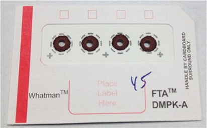 DBS Card after Blood Sample Addition and 3 mm Spot Punch-out