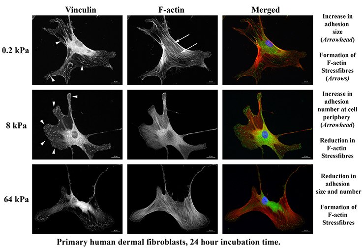Primary human dermal fibroblast matrix stiffness optimization.