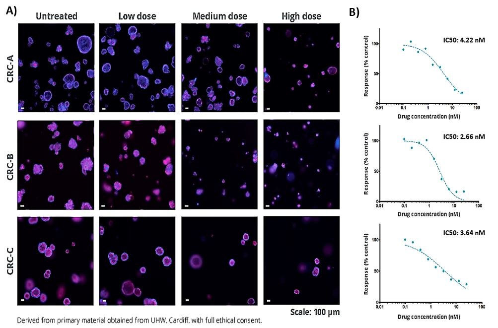 Confocal microscopy images of human CRC organoids in a drug screening experiment.