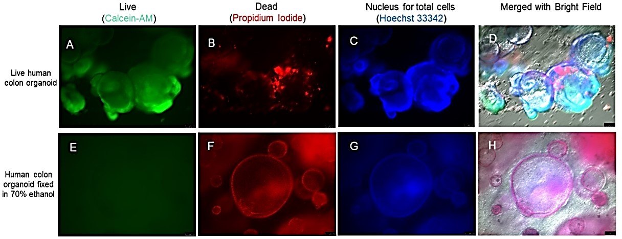 Microscopy images of live human iPSC-derived colon organoids stained with cell viability assay kit