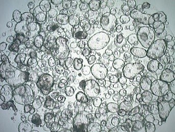 Human colon organoids